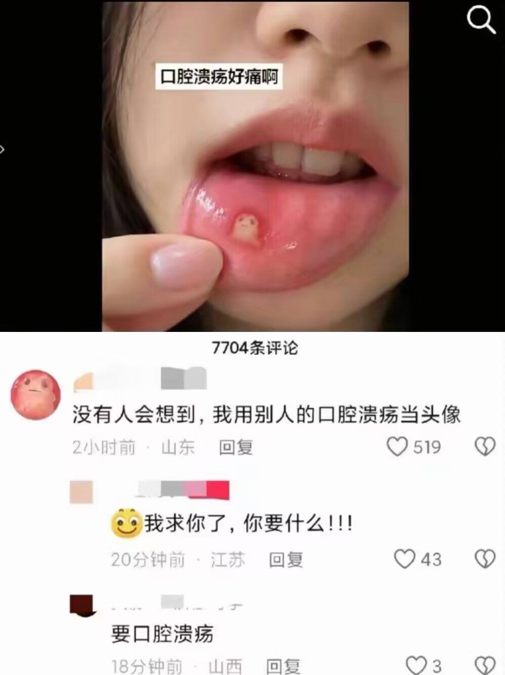 有人拿别人的口腔溃疡当头像，评论区还排队求同款